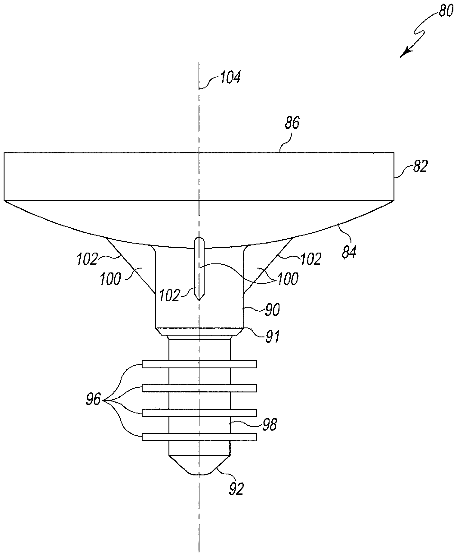 Modified glenoid components and methods of installing same