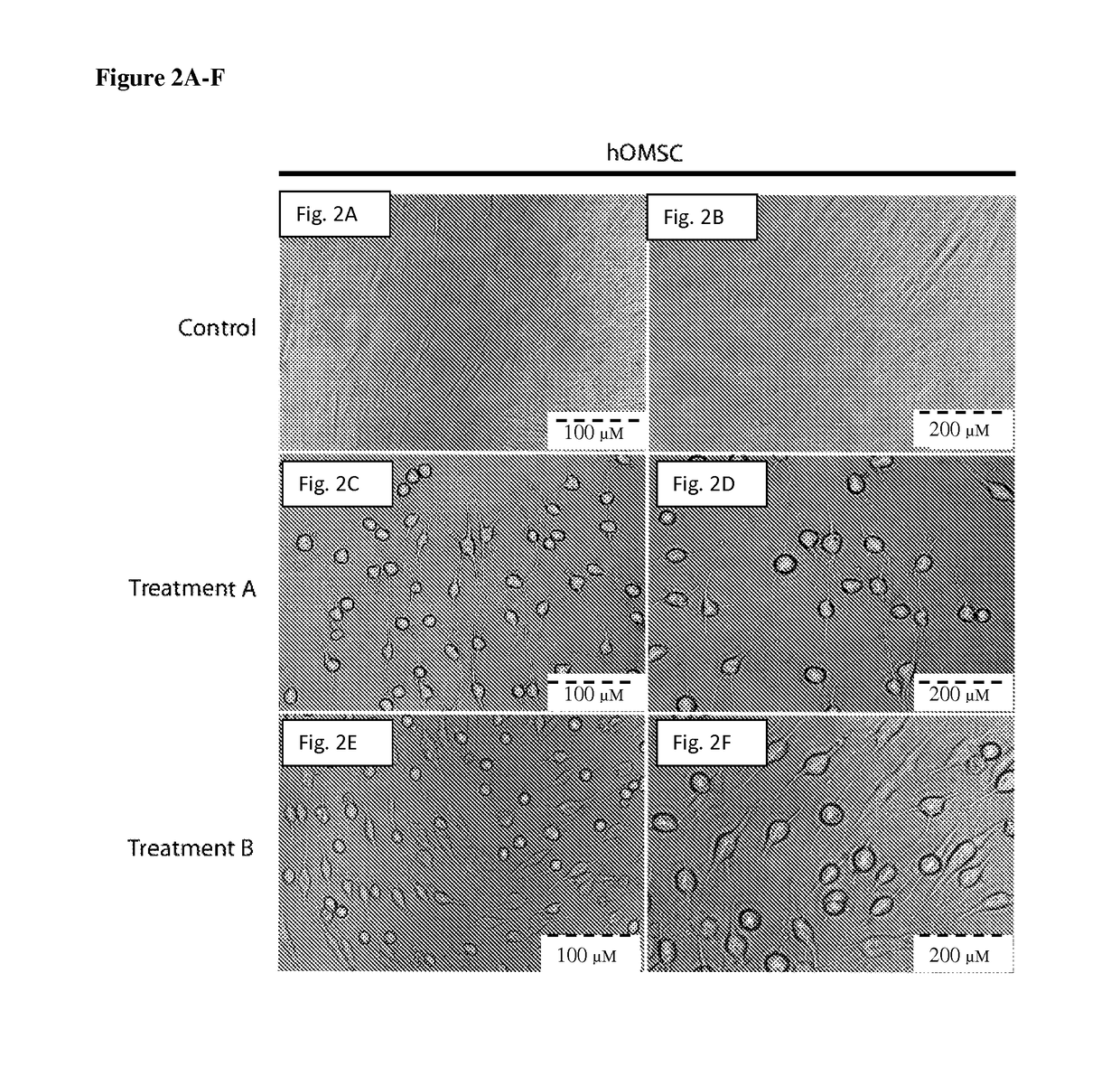 Stem cell-derived neural cells for cell therapy in neurological disorders