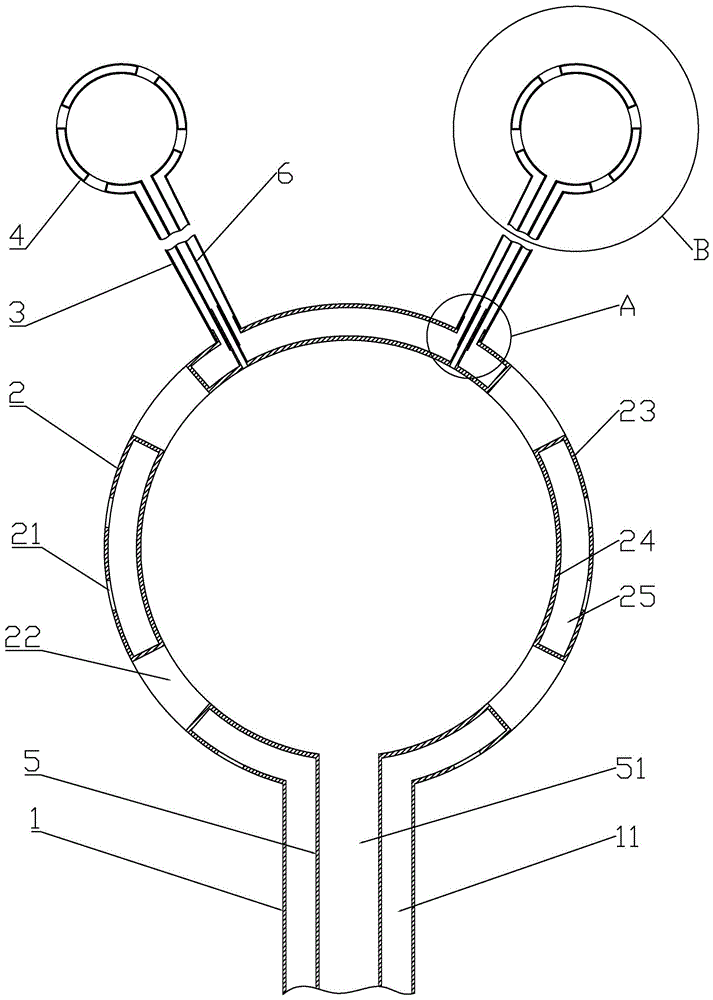 Perianal postoperative closed double-cavity irrigation negative pressure drainage device and using method