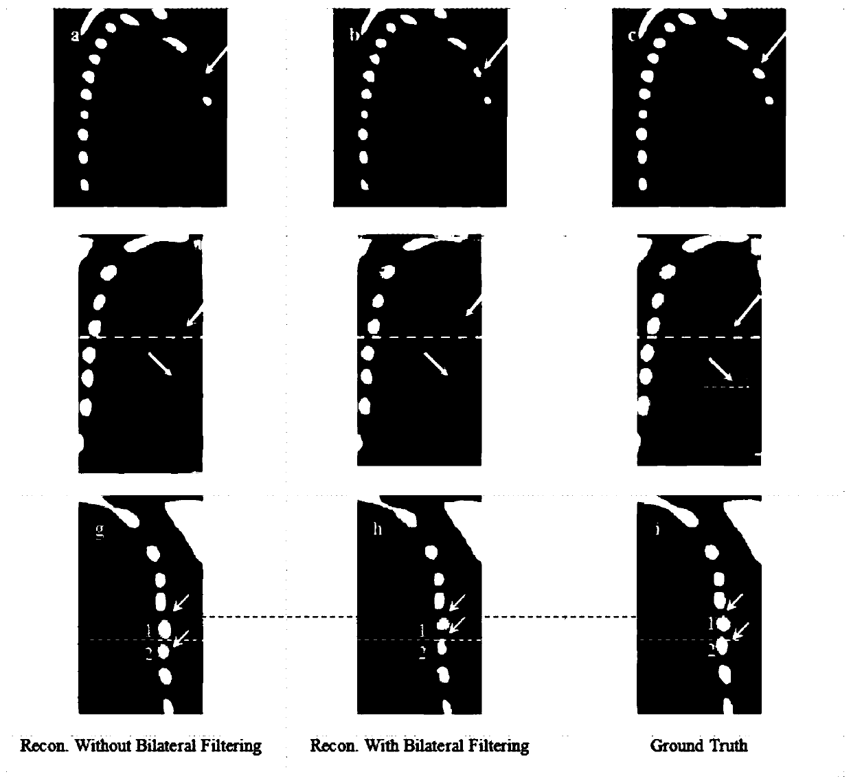 Motion compensation high-quality 4D-CBCT image reconstruction method based on bilateral filtering