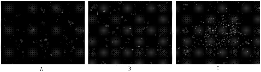 A kind of irinotecan hydrochloride composition and preparation method thereof