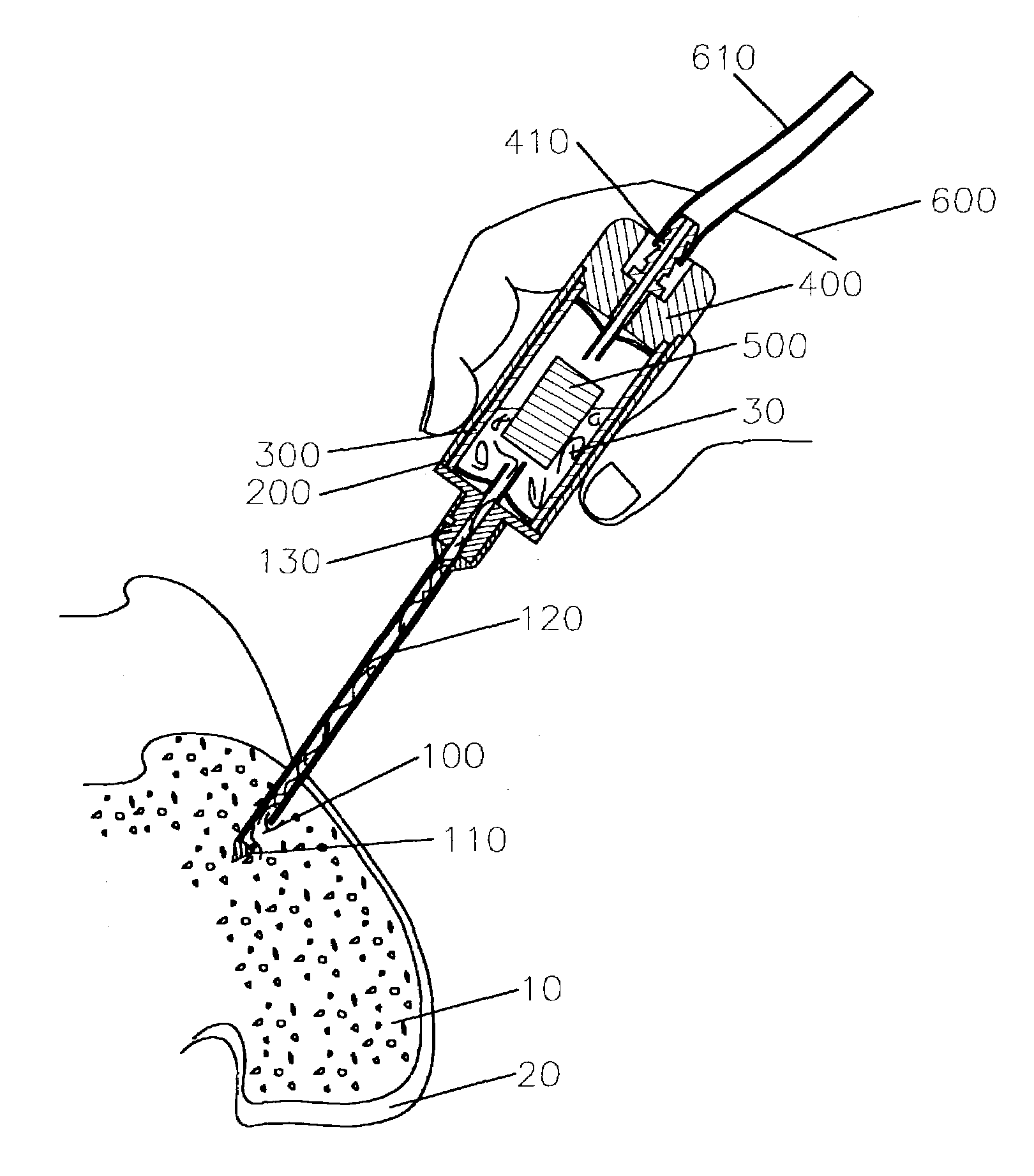 Bone marrow aspiration and biomaterial mixing system