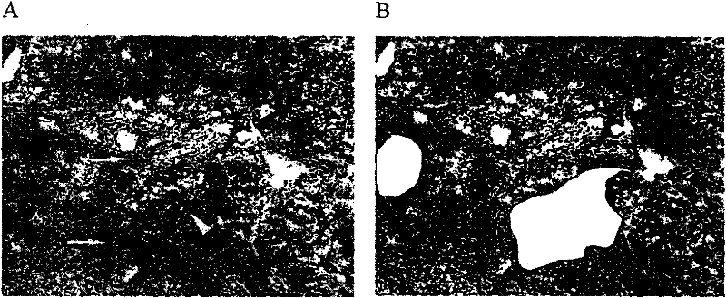 Haplotype of tumor metastatic suppressor gene HTPAP as well as construction method and application thereof