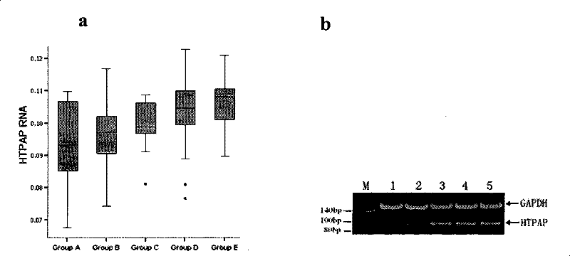 Haplotype of tumor metastatic suppressor gene HTPAP as well as construction method and application thereof