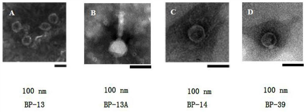 Novel staphylococcus aureus phage as well as composition and application thereof