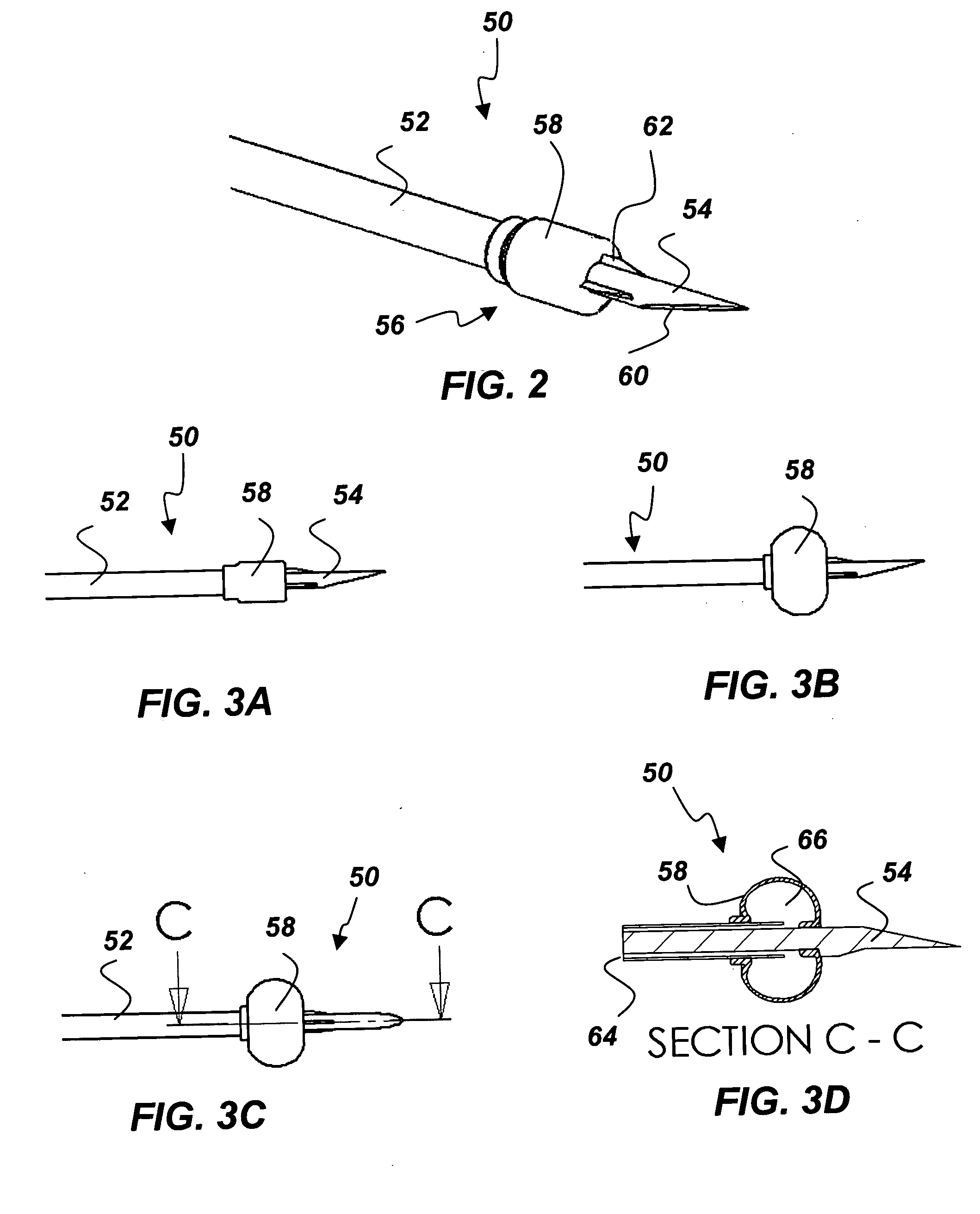 Mechanisms and methods used in the anastomosis of biological conduits