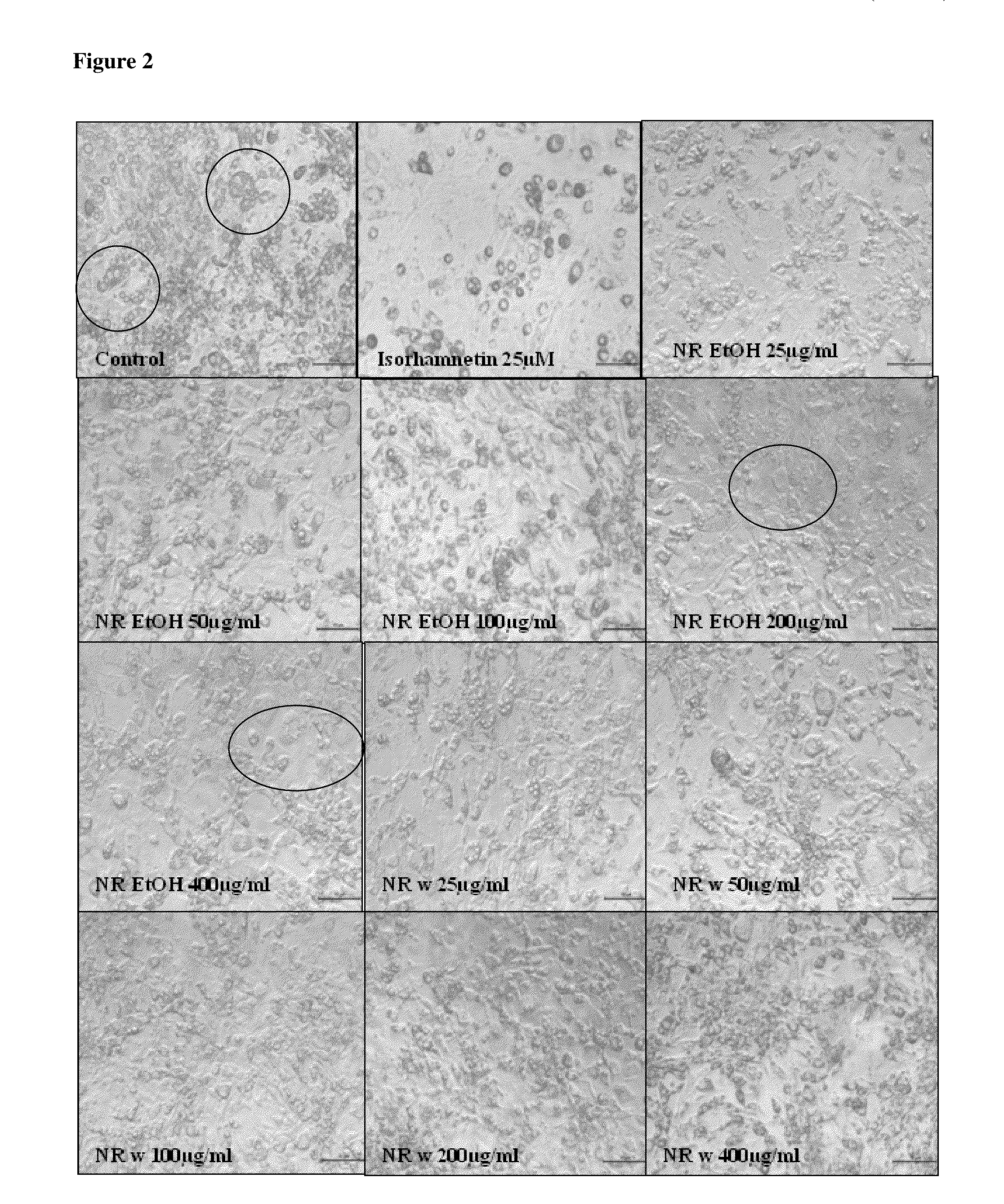 Compositions and methods for treating or ameliorating obesity or for reducing diabetic hypercholesterolemia