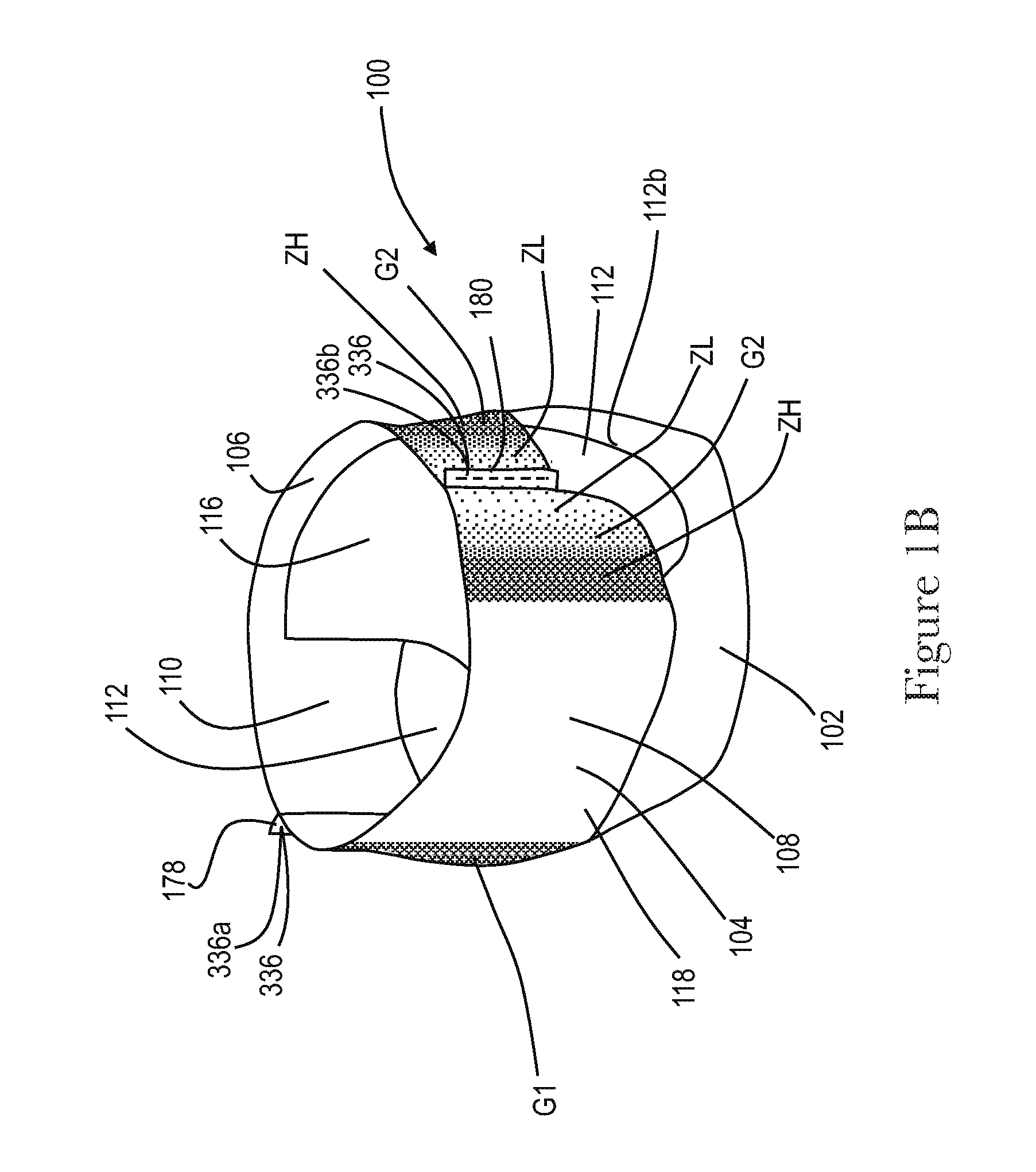 Apparatuses and Methods for Making Absorbent Articles with Low Intensity Side Seam Regions