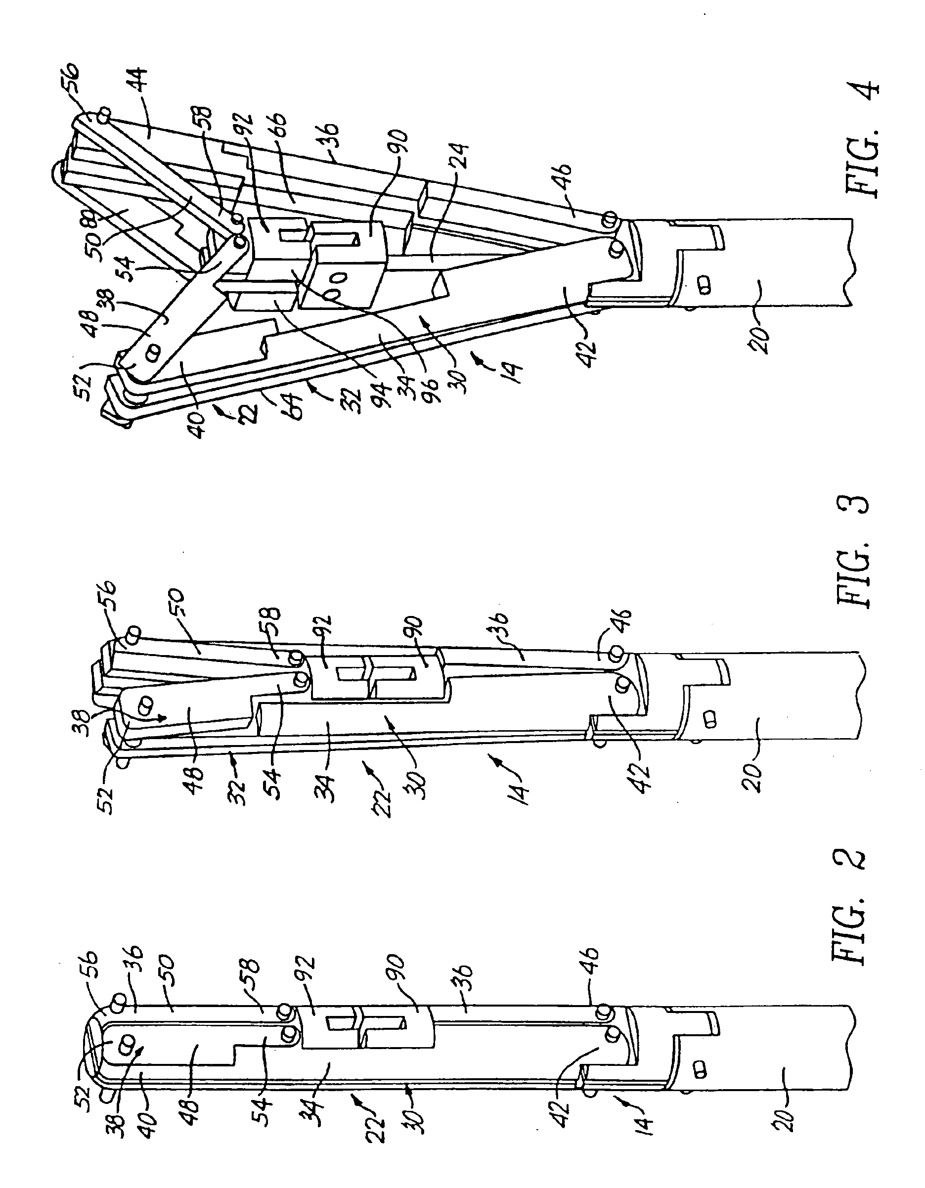 RF device for treating the uterus