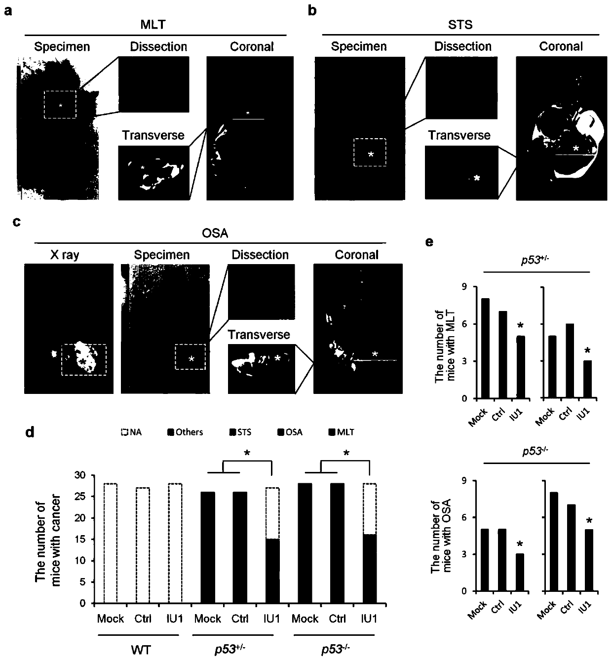 Application of IU1 in preparing drugs for treating p53-deficient tumors