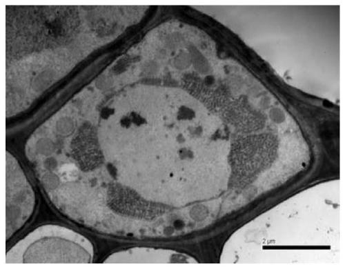 Dual RT-PCR method for the simultaneous detection of wheat dwarf virus and wheat yellow streak virus