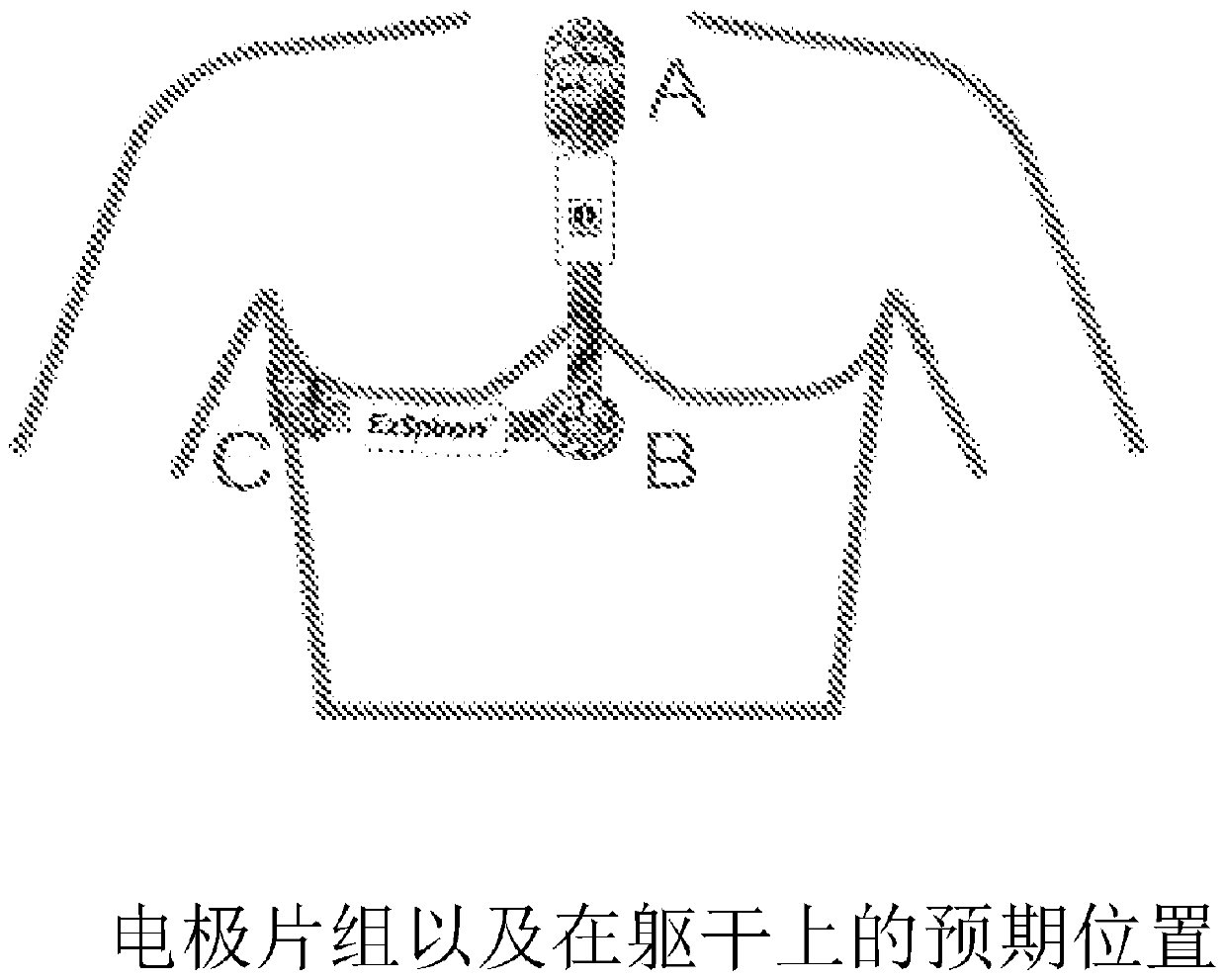 Advanced respiratory monitor and system