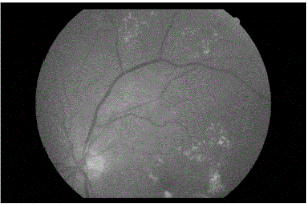 Arteriovenous retinal vessel optic disk positioning method of eye fundus image
