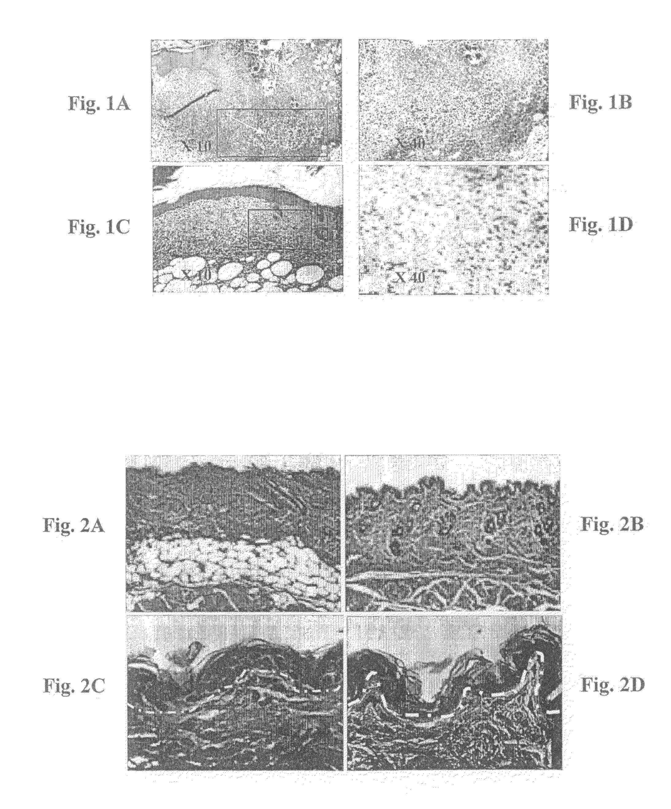 Method and compositions for prevention and treatment of diabetic and aged skin