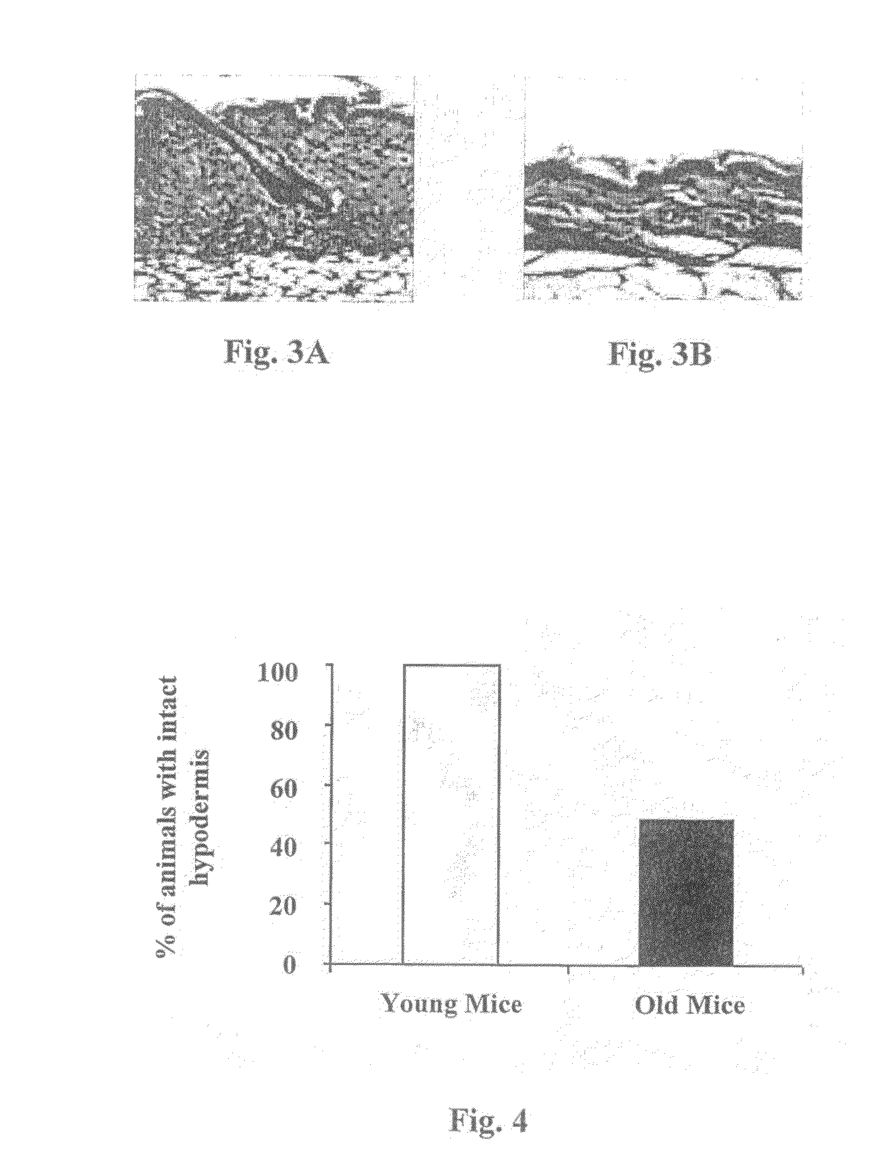 Method and compositions for prevention and treatment of diabetic and aged skin