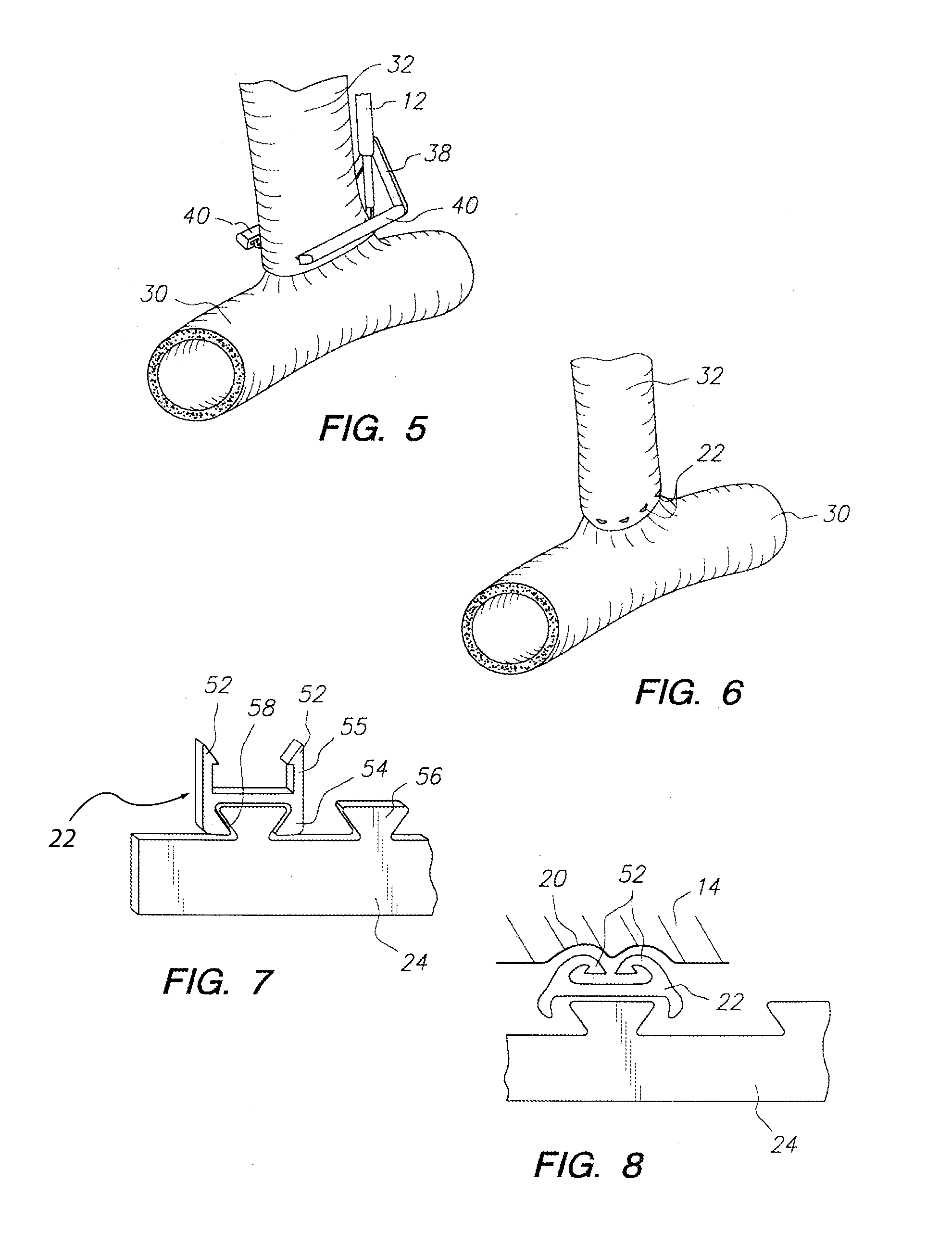 Anastomosis System with Anvil Entry Hole Sealer