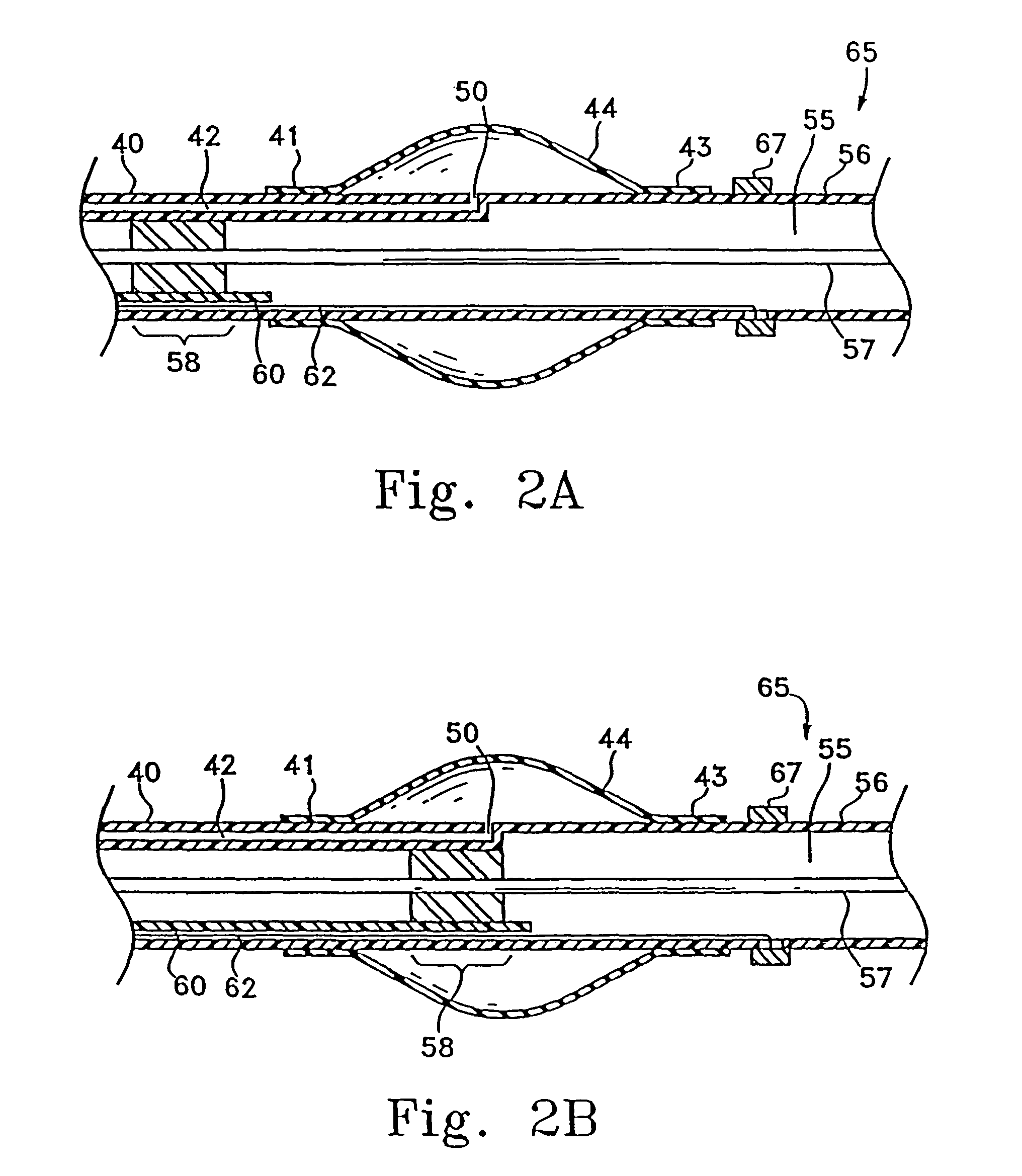 Long nose manipulatable catheter