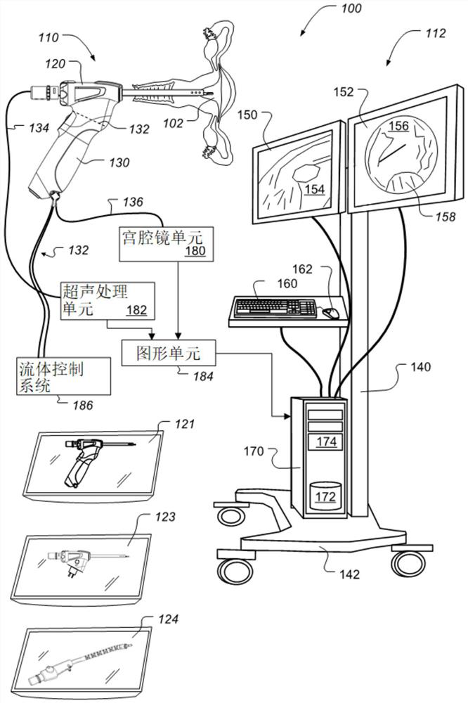 Combined ultrasound and endoscopy system