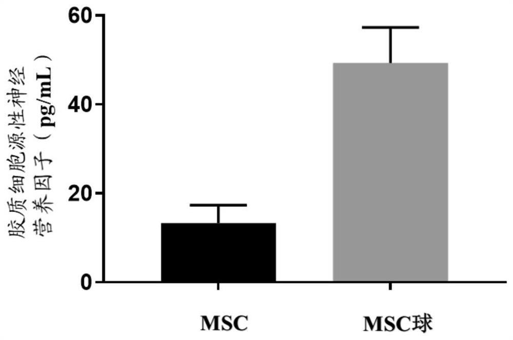 Double-layer gel system carrying mesenchymal stem cell spheres as well as preparation method and application of double-layer gel system