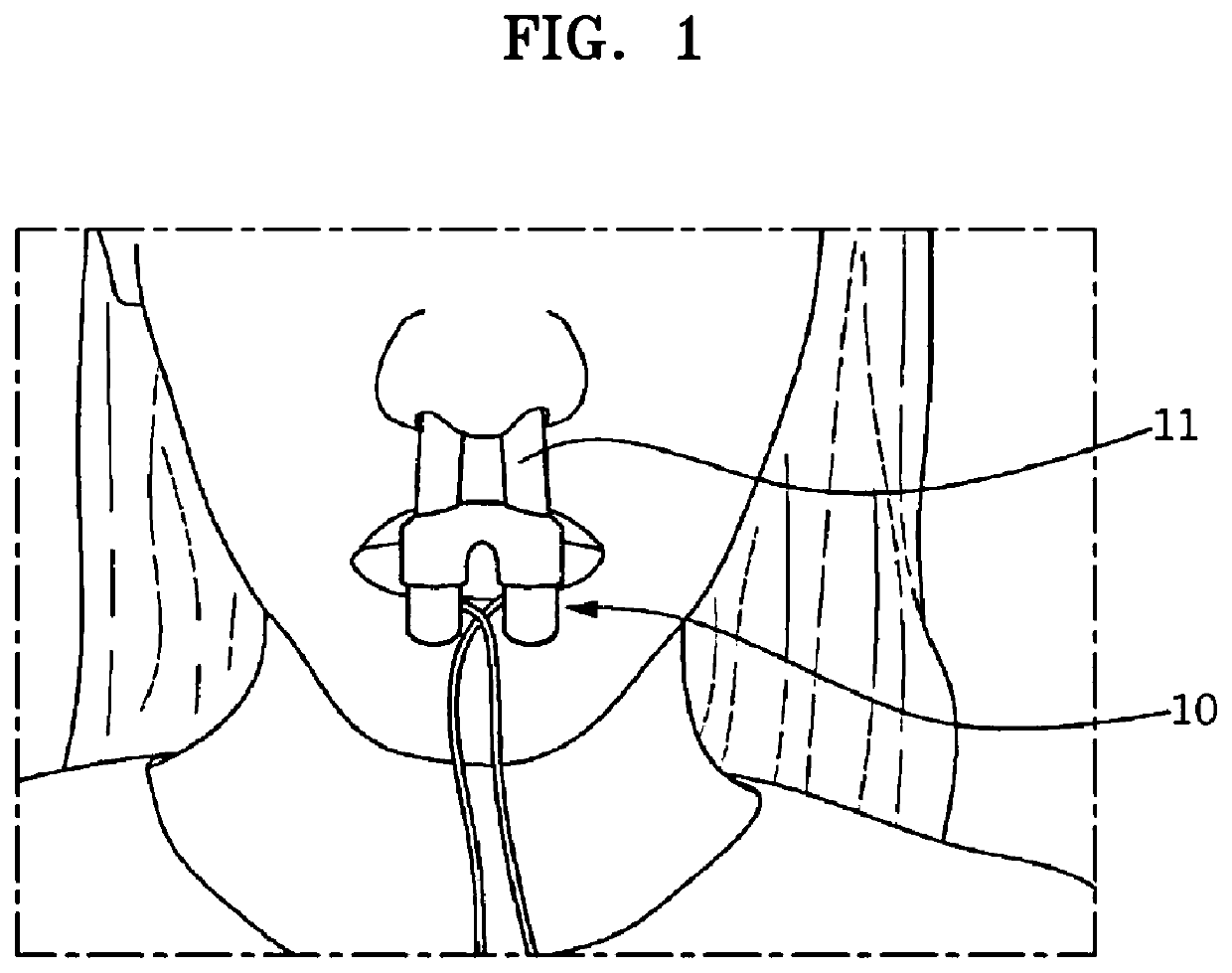 Face-wearable rhinitis treatment device using light therapy