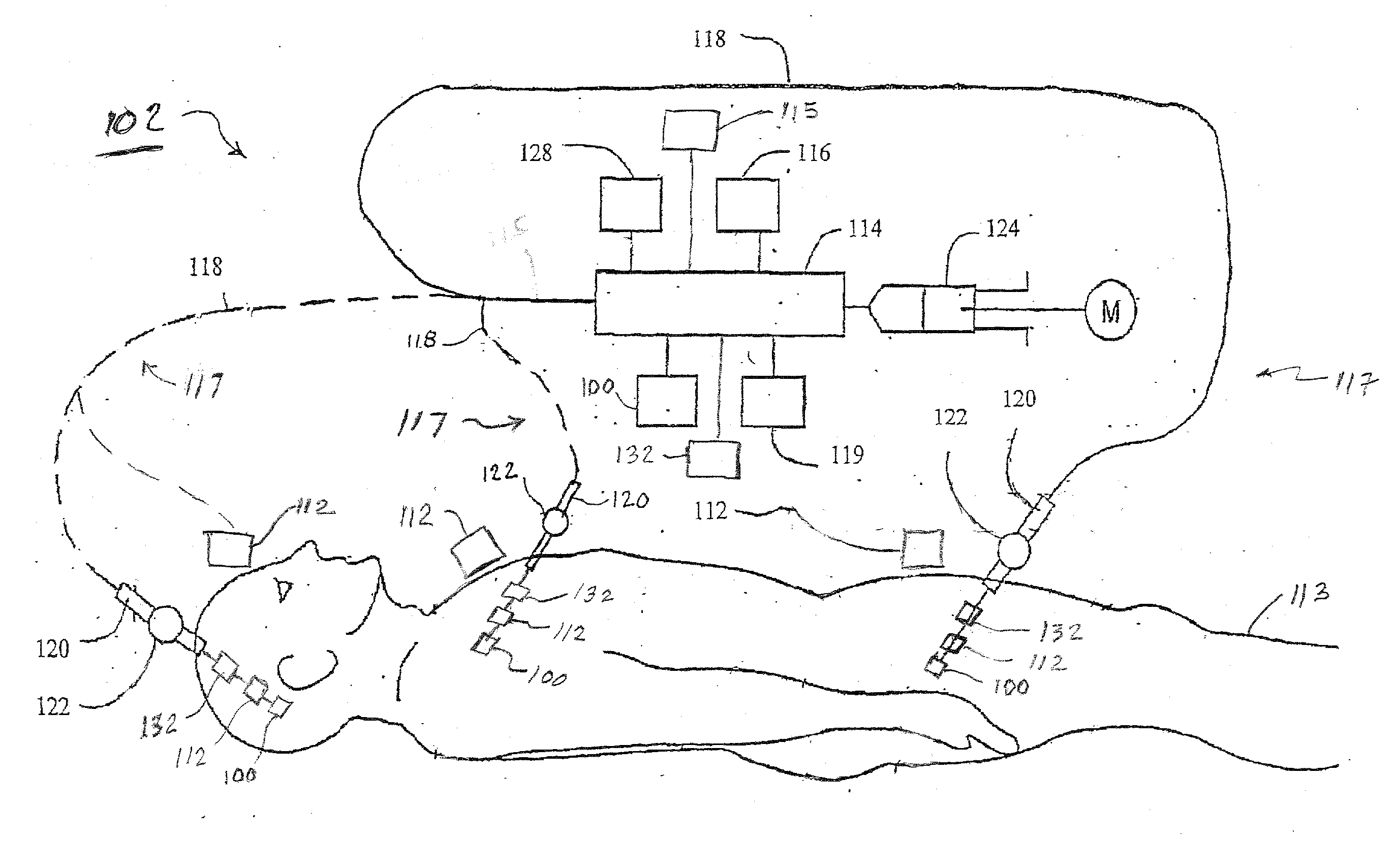 System for Treatment and Imaging Using Ultrasonic Energy and Microbubbles and Related Method Thereof