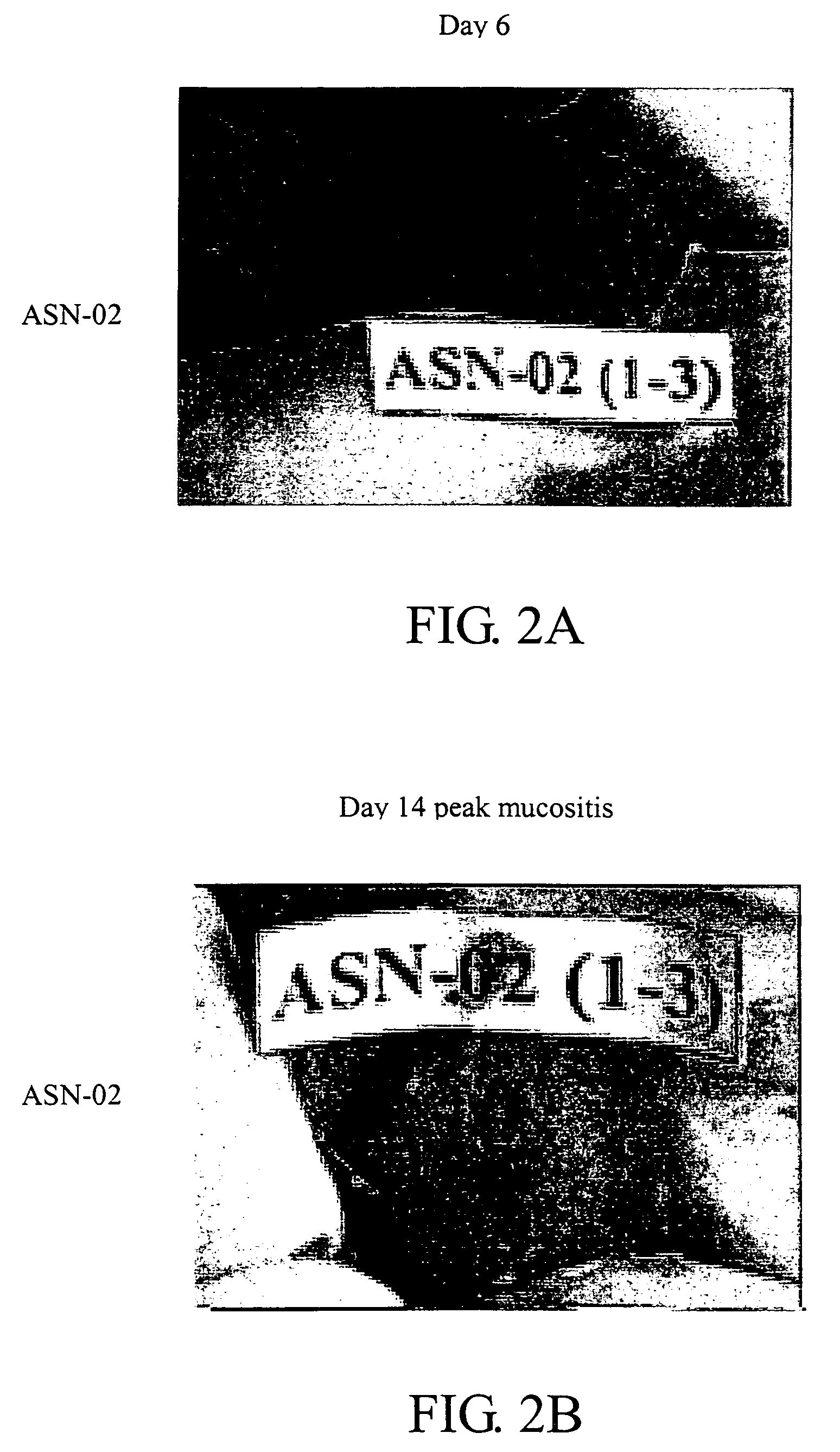 Method and compositions for treatment of epithelial damage