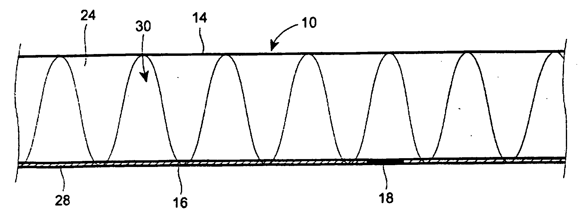 Multi-layer nonwoven having a printed layer and products made therefrom