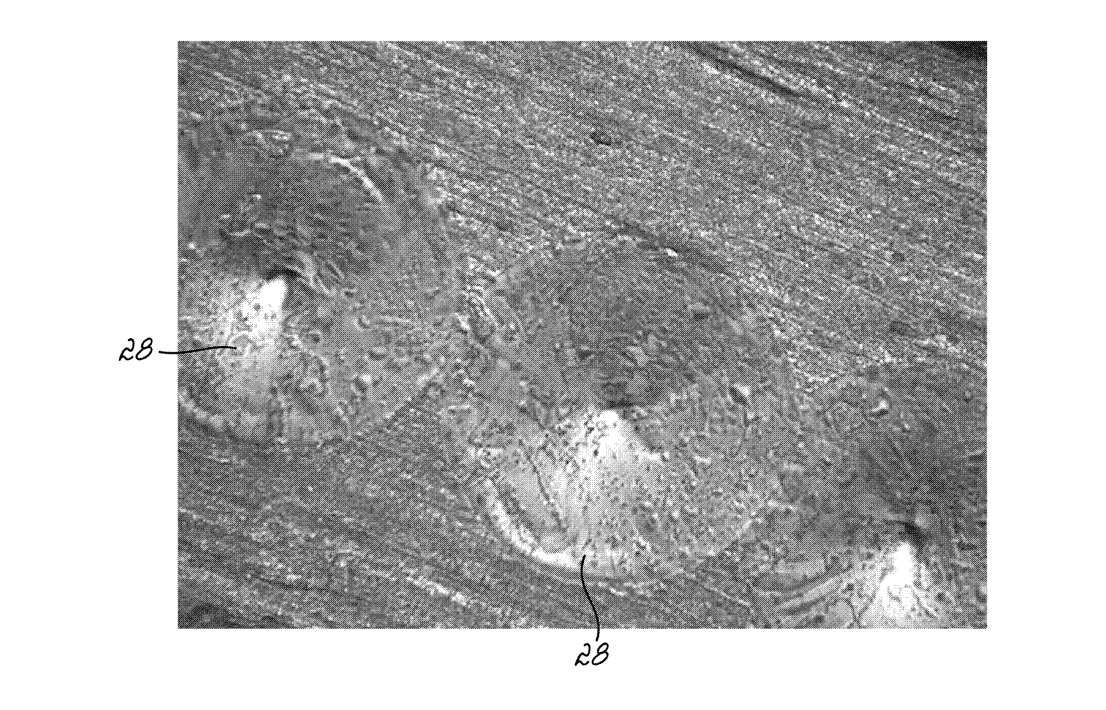 Orthodontic appliances and methods of making and using same