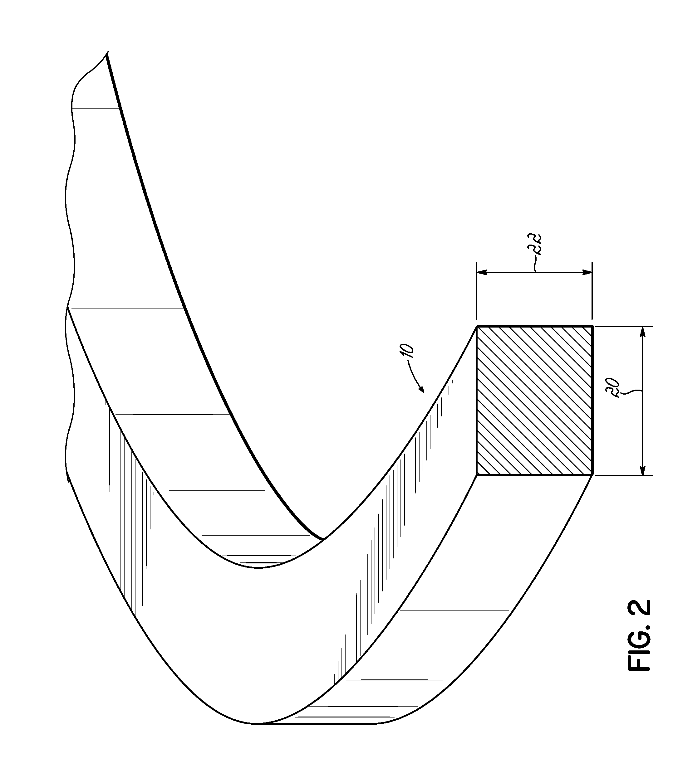 Orthodontic appliances and methods of making and using same