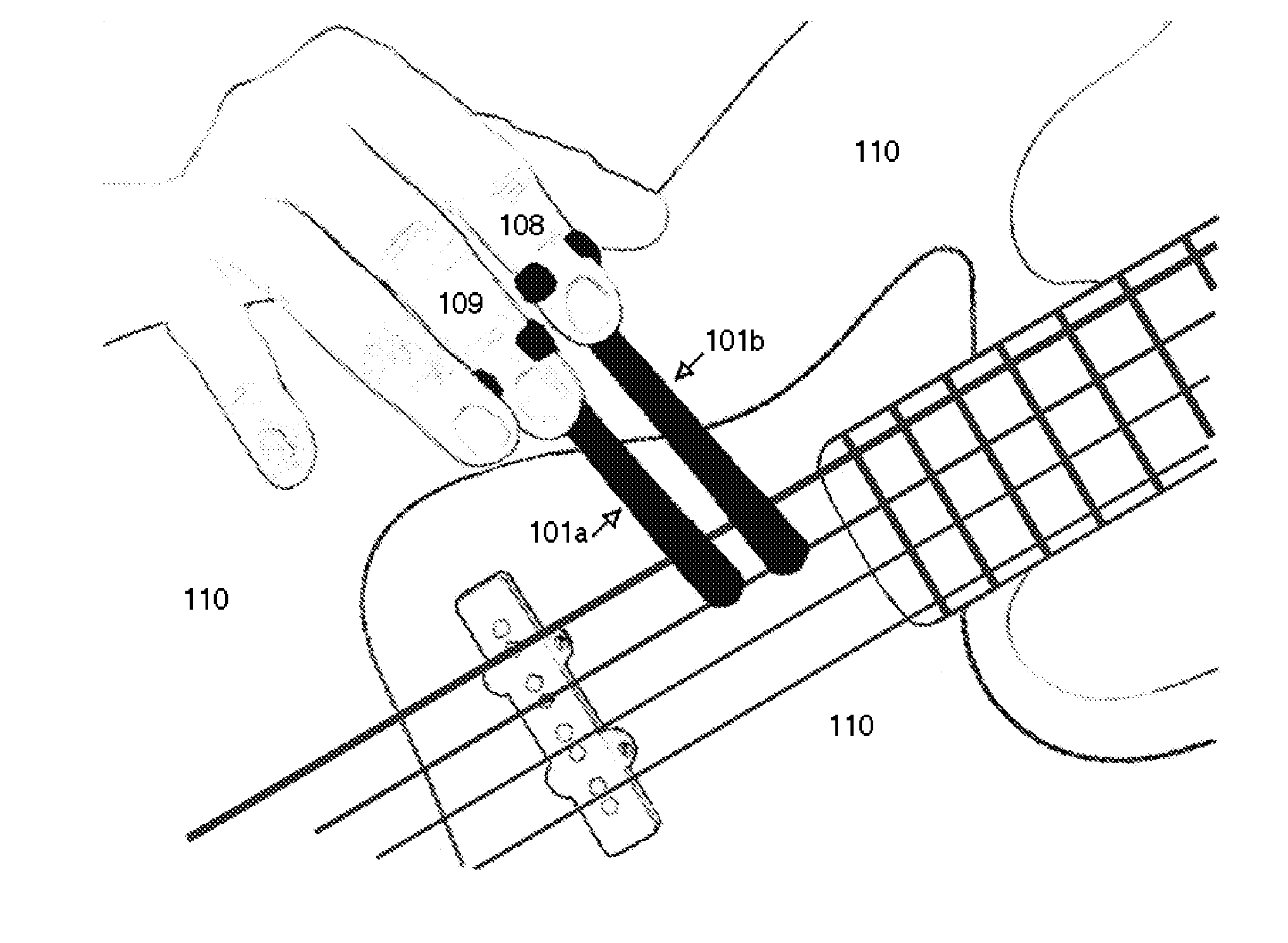 Finger-mounted striking devices for activating musical instrument strings