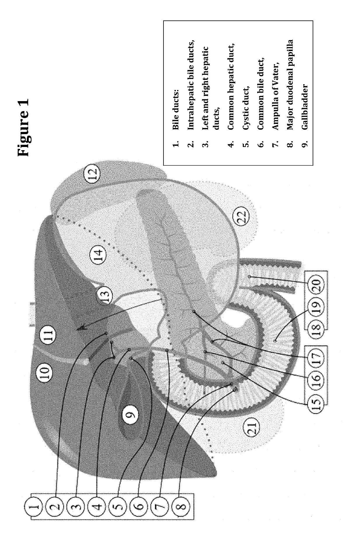 Treatment of Biliary Duct Cancer