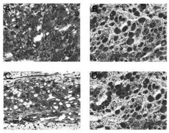 A device for extracting adipose-derived stromal vascular components and its extraction method