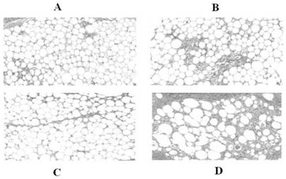 A device for extracting adipose-derived stromal vascular components and its extraction method