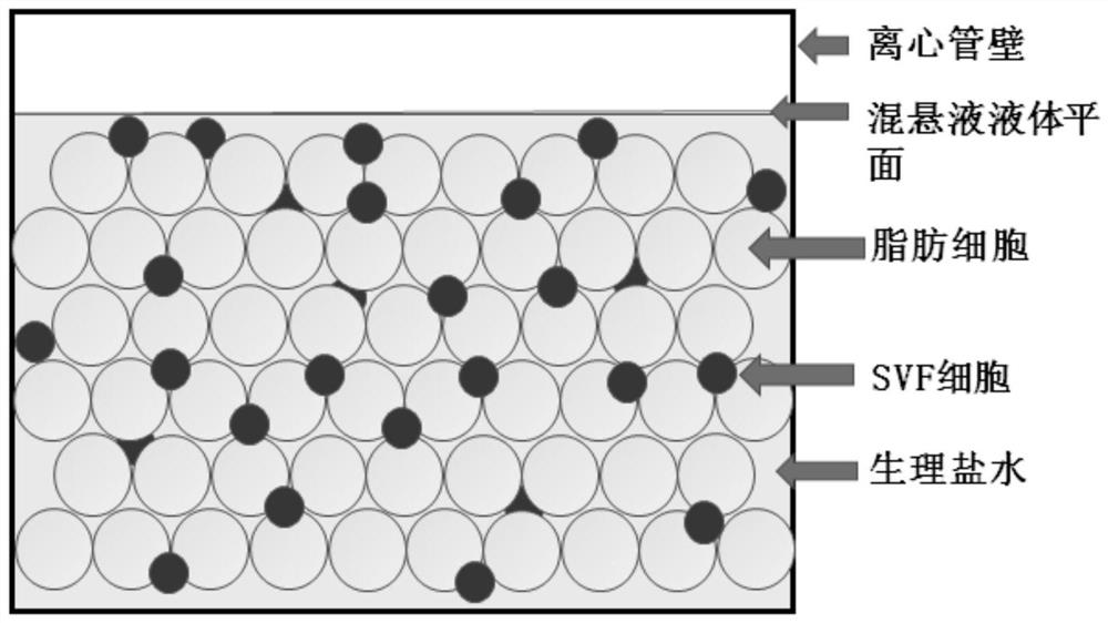 A device for extracting adipose-derived stromal vascular components and its extraction method