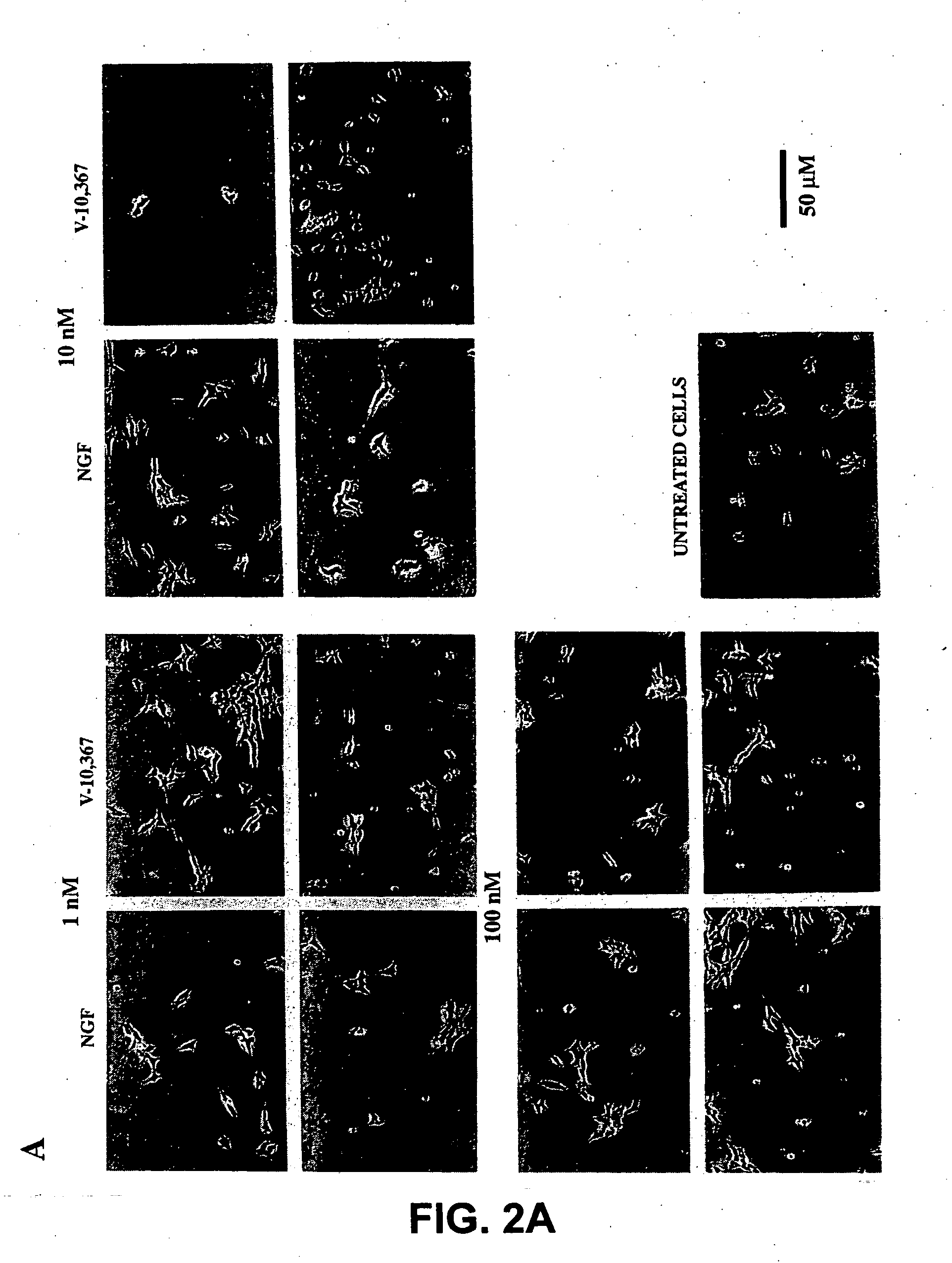 Compositions and methods for promoting nerve regeneration