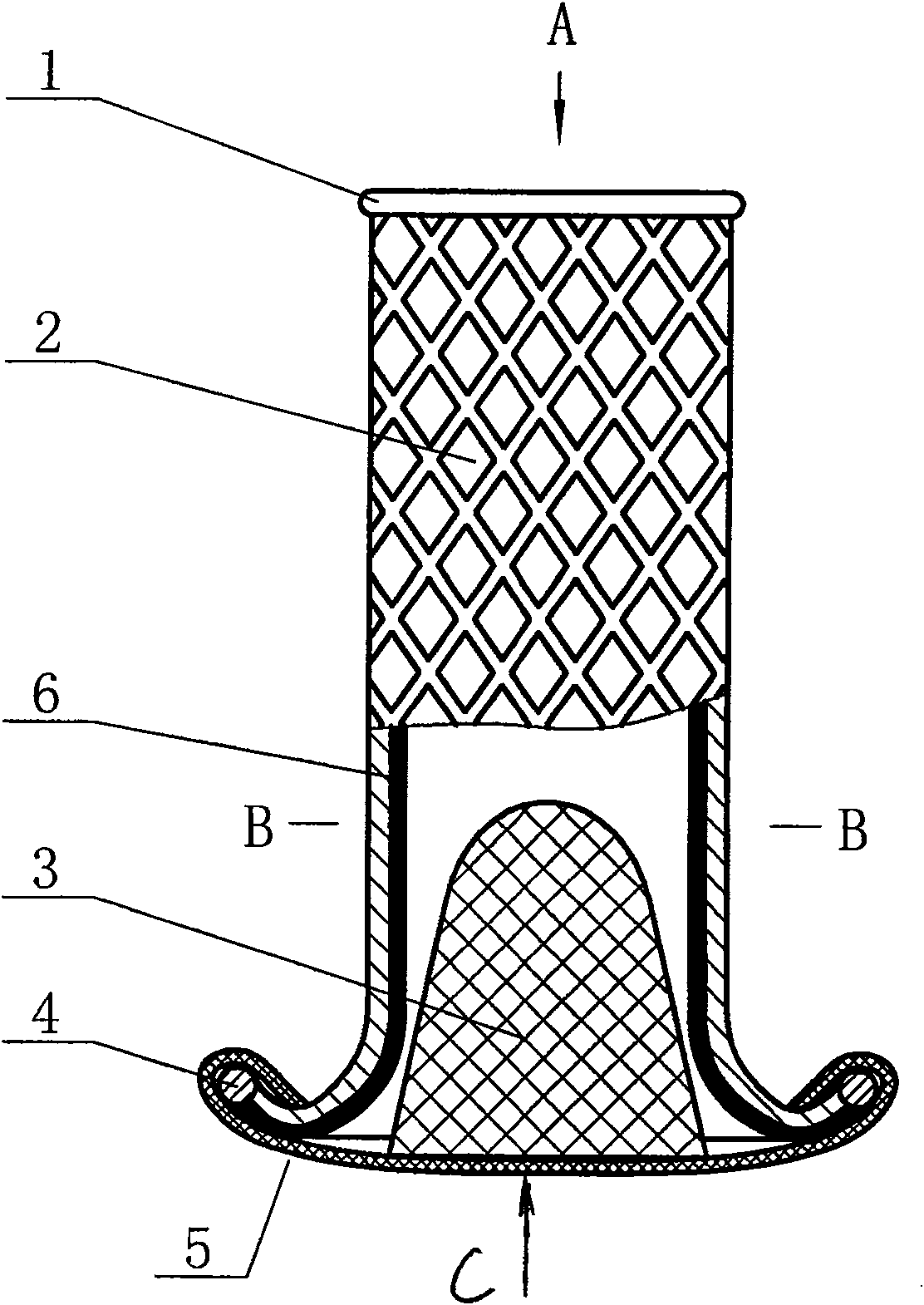 Intracervical device containing traditional chinese medicine milkwort for killing semen