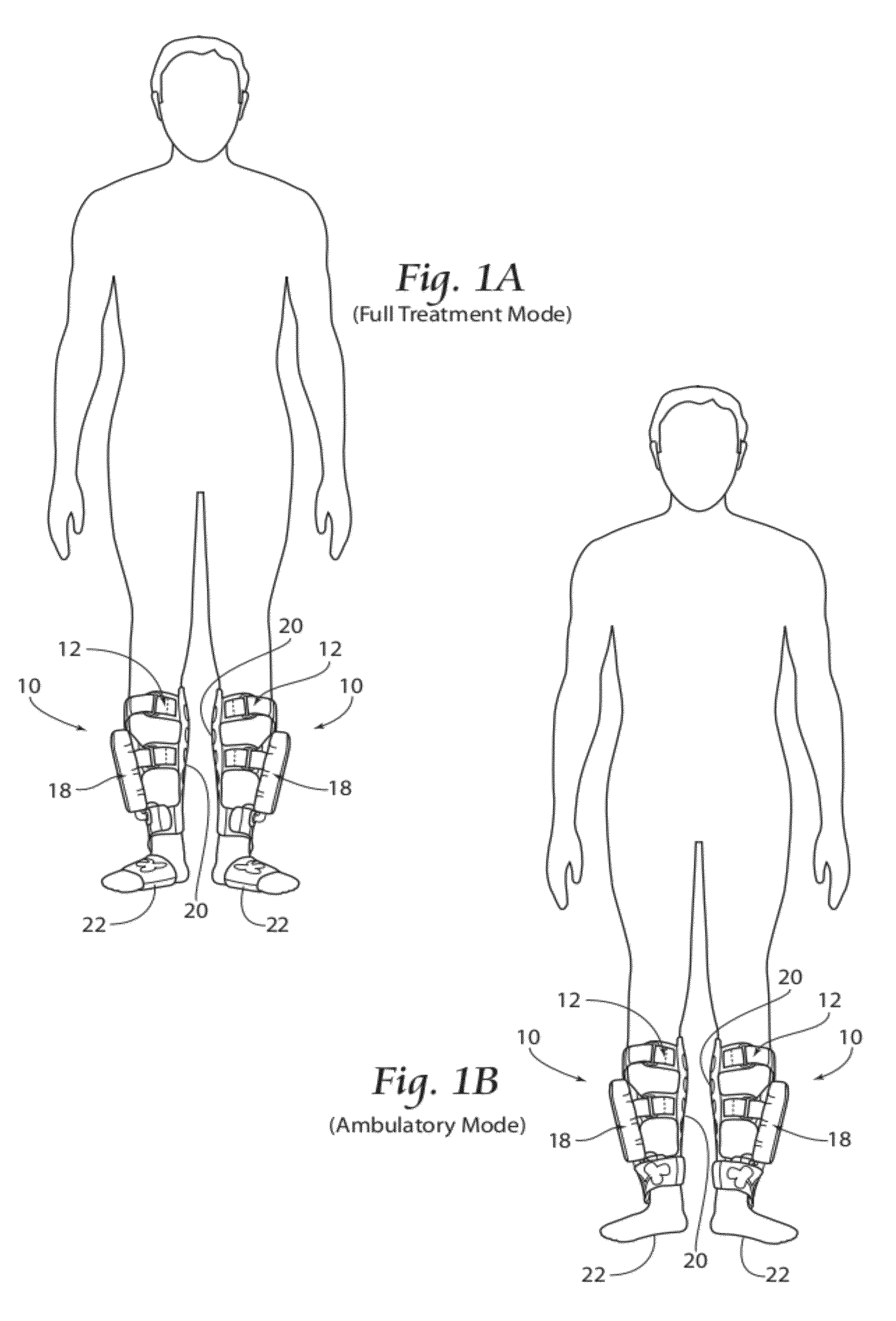 Apparatus, systems, and methods for augmenting the flow of fluid within body vessels