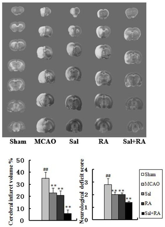 A pharmaceutical composition for reducing brain damage caused by cerebral apoplexy using rosmarinic acid