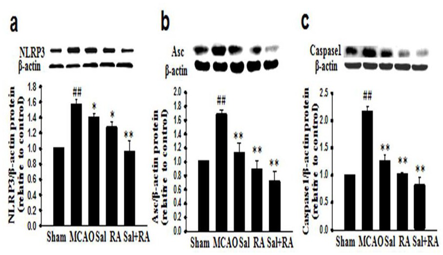 A pharmaceutical composition for reducing brain damage caused by cerebral apoplexy using rosmarinic acid