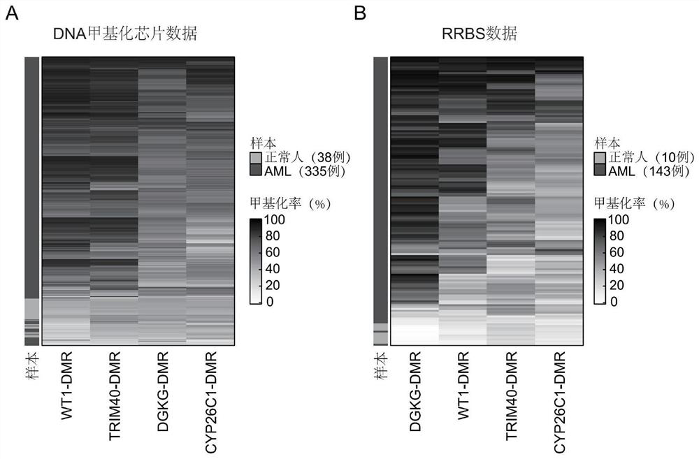 Novel diagnostic method of acute myeloid leukemia and application thereof