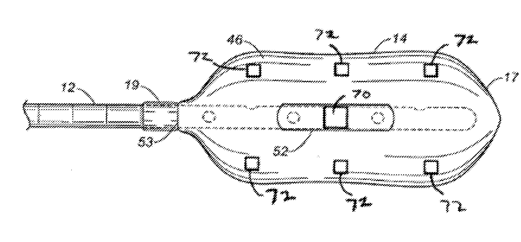 Rectal balloon with sensor cable
