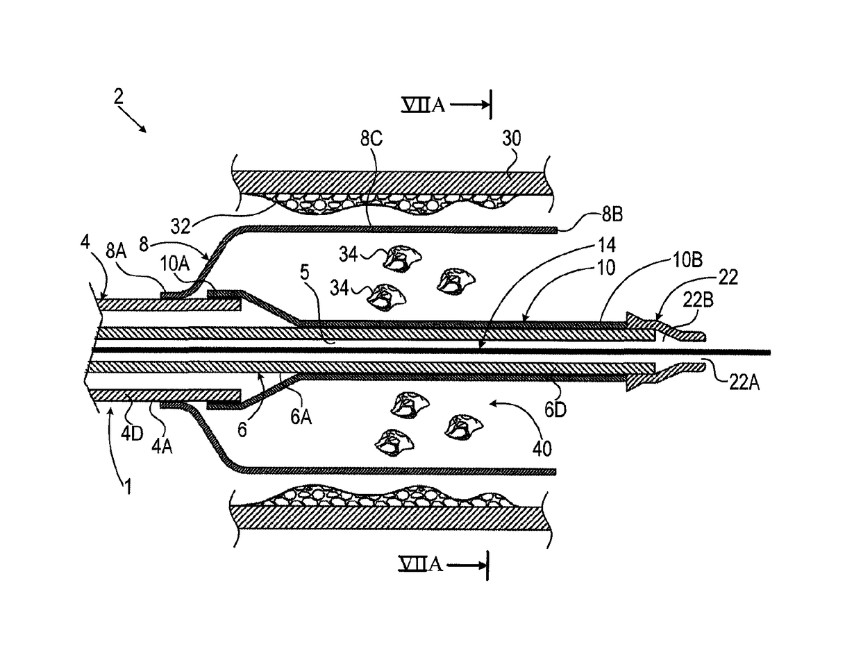 Balloon catheter and methods of use thereof