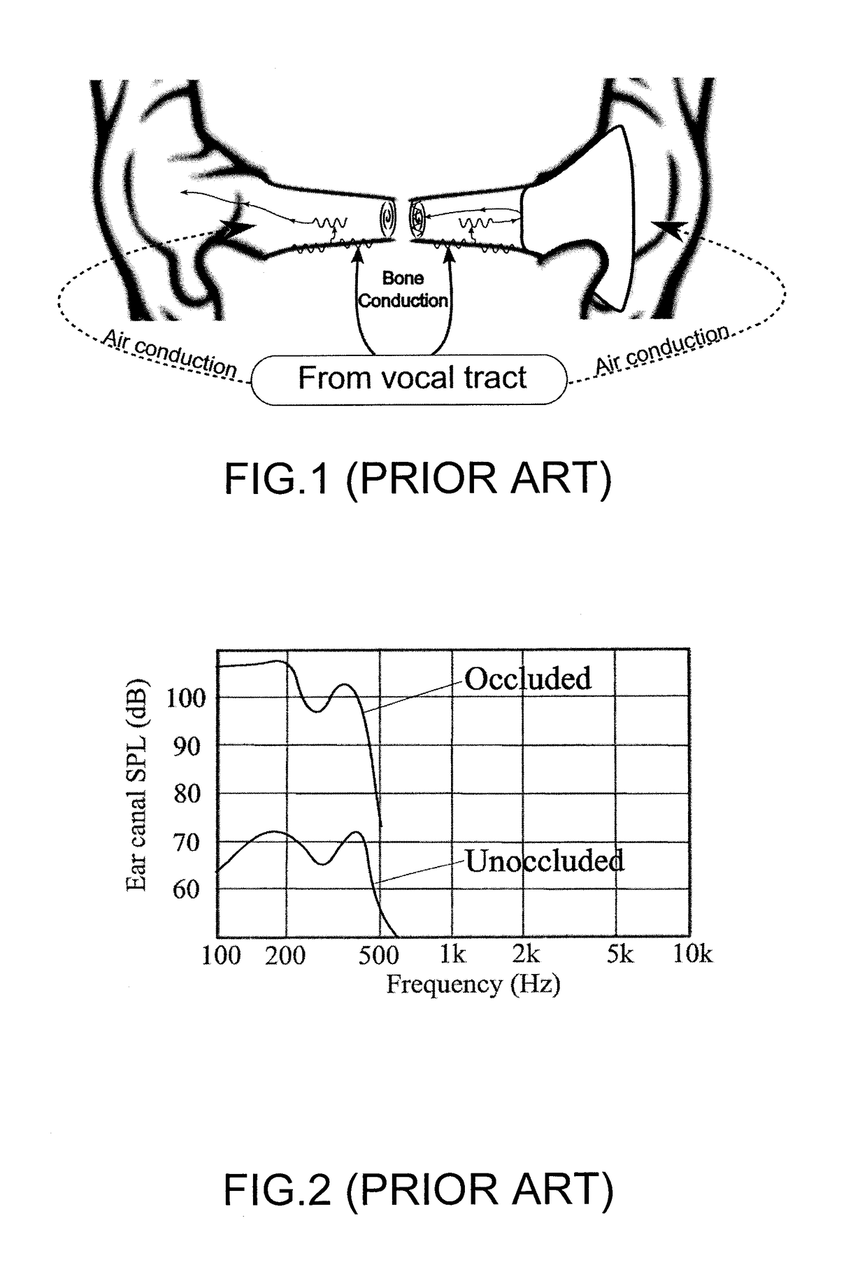 Active hearing protection device and method therefore