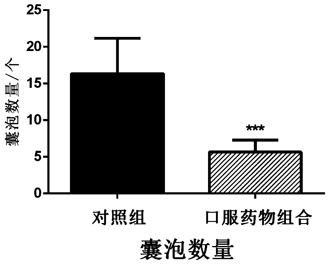 A kind of pharmaceutical composition and pharmaceutical preparation for treating echinococcosis and application thereof