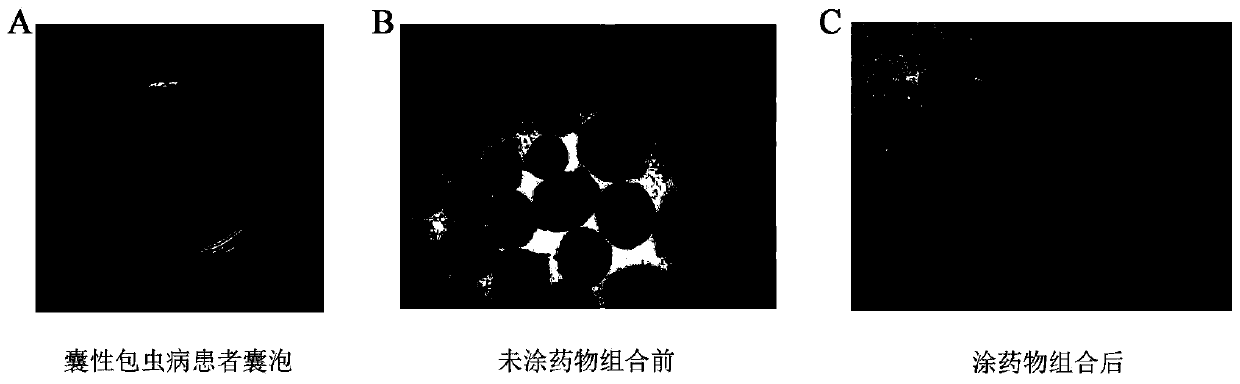 A kind of pharmaceutical composition and pharmaceutical preparation for treating echinococcosis and application thereof