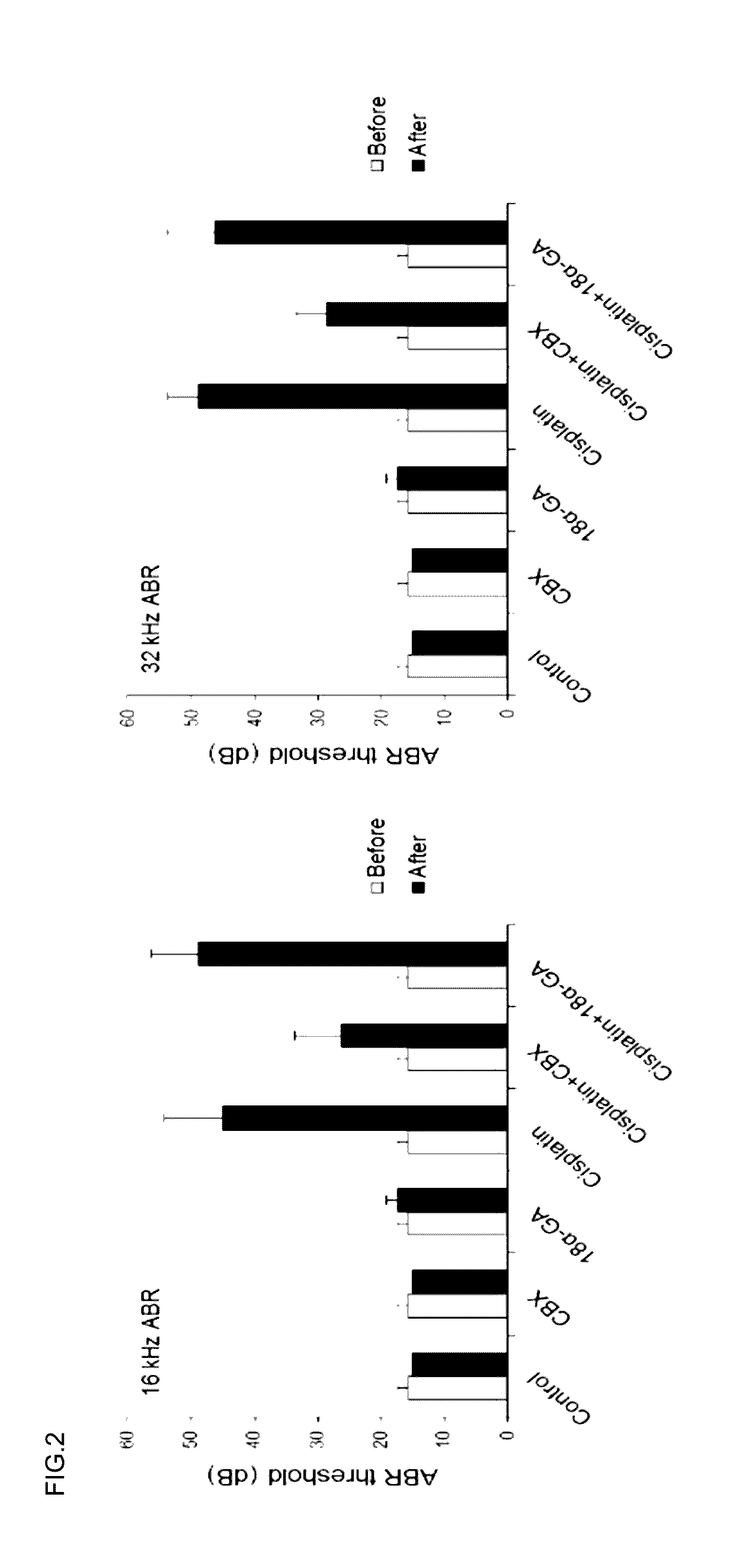 Pharmaceutical composition for preventing or treatinghearing loss, comprising carbenoxolone or its pharmaceutically acceptable salts as effective compound