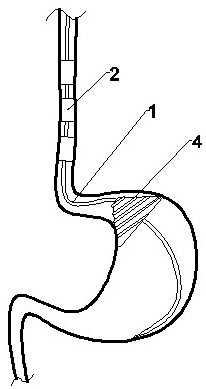Multi-cavity multi-bag tube capable of achieving fixed-point hemostasis