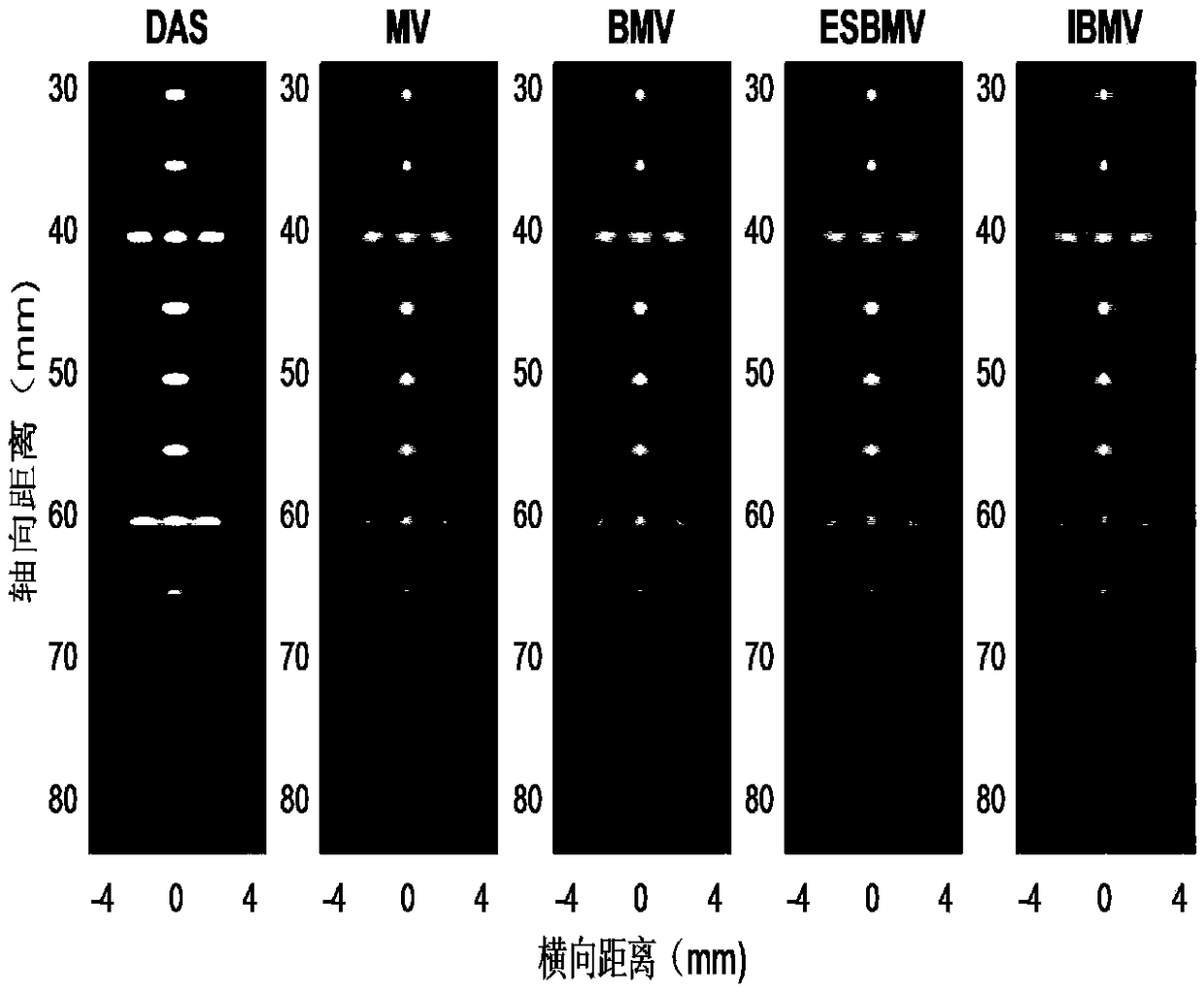 Eigenvalue decomposition-fused low-complexity minimum variance ultrasound imaging method