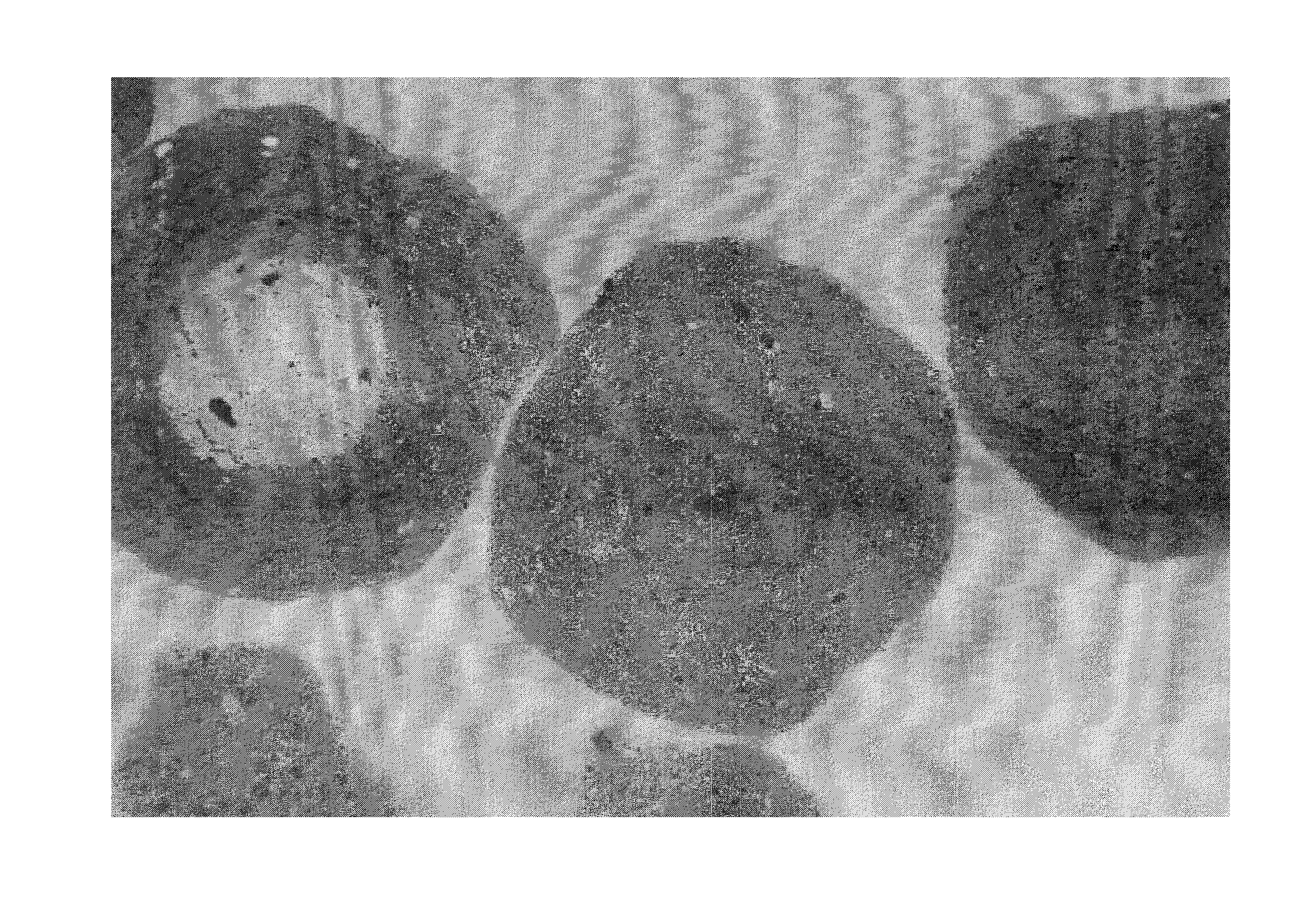Method of treating subterranean formations with porous particulate materials