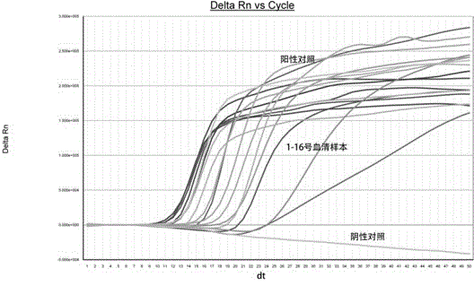 HBV (hepatitis B virus) real-time fluorescent nucleic acid isothermal amplification detection kit